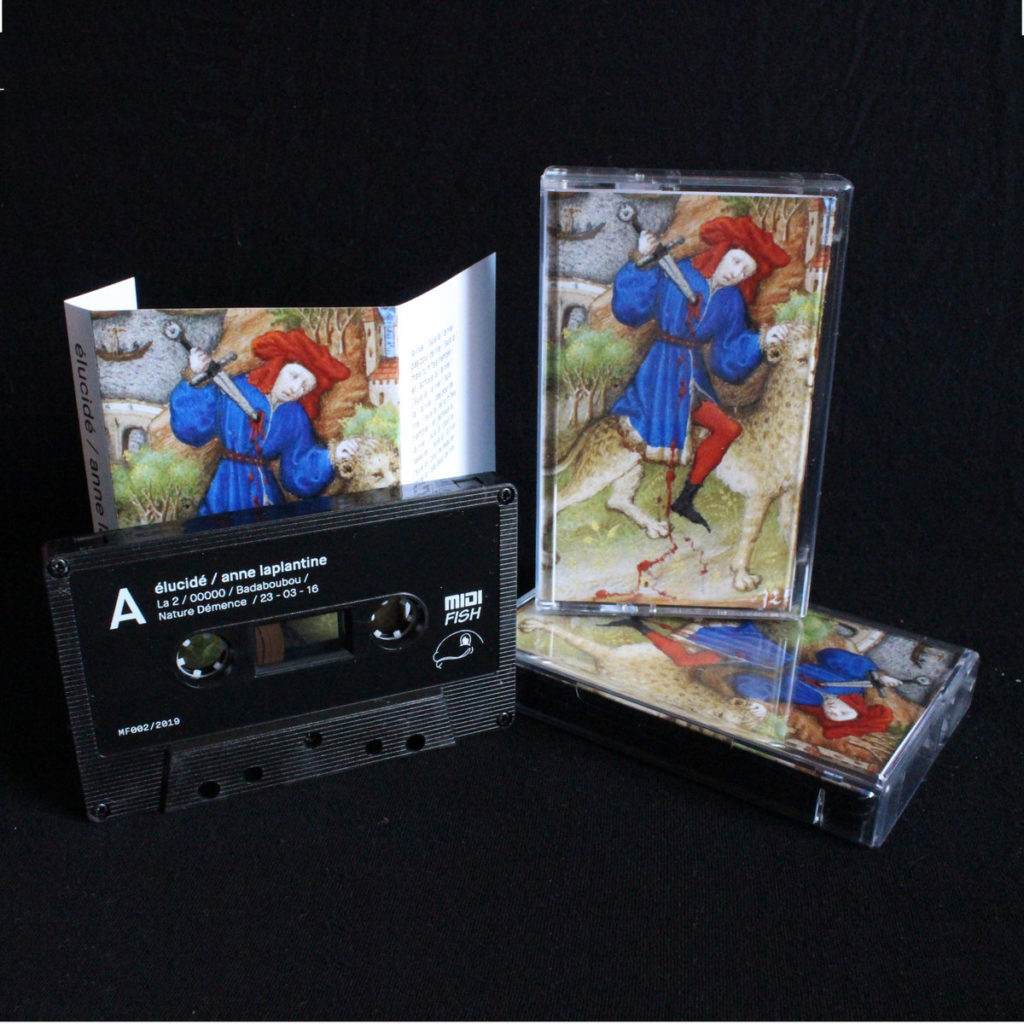 Musique Journal -   Enfin une bonne nouvelle : la scène chouine-core ne s’est jamais aussi bien portée !